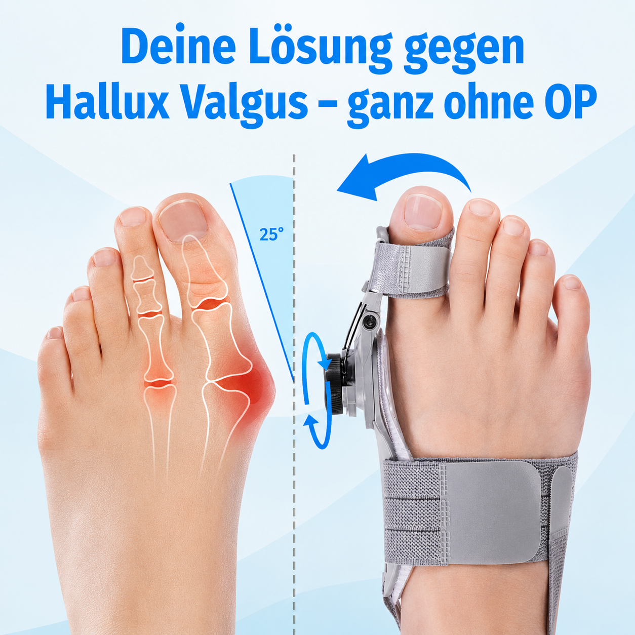 Hallux-Valgus Schiene